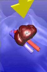 Cardiac Pump