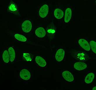 Picture of immunofluorescence staining pattern of dsDNA antibodies.