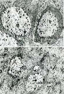 Two black-and-white photos; one shows dark, fairly regular rings on a lighter background, and the other shows irregular, smaller, and not as dark clusters.