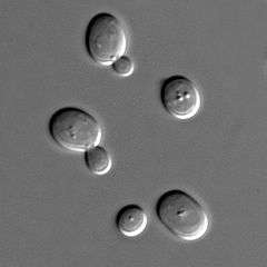 Microscopic view of five spherical structures; one of the spheres is considerably smaller than the rest and attached to one of the larger spheres